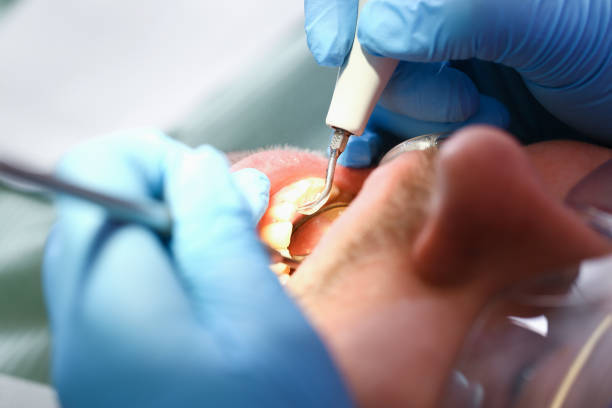 Best Emergency Denture Repair in North Sioux City, SD